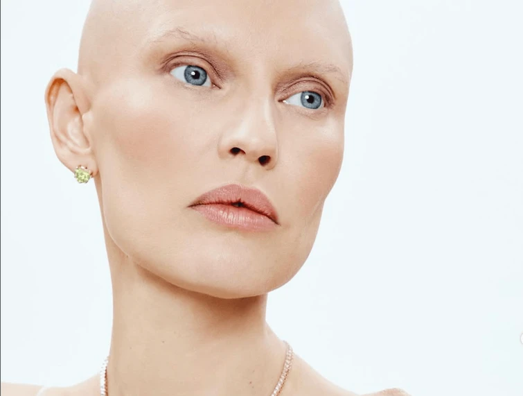 Bianca Balti sapeva del probabile cancro ma non si è operata Non voglio sentirmi in colpa non accetto più questa critica
