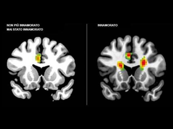 Alla ricerca dellamore ecco quali zone del cervello si illuminano quando si ama un partener un figlio o un animale