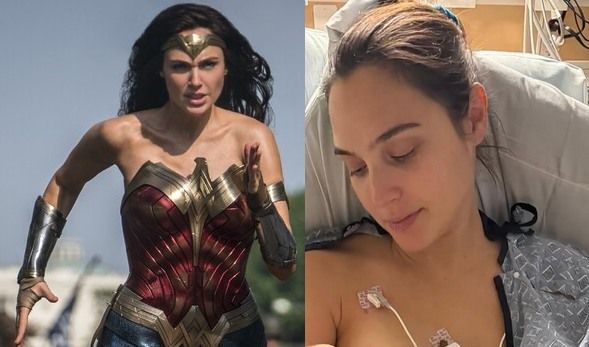 La paura di Wonder Woman Gal Gadot operata al cervello Tutto ciò che volevo era vivere