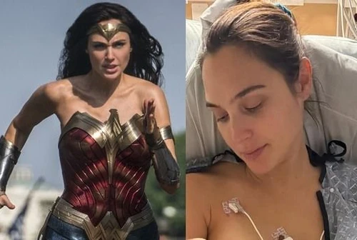 La paura di Wonder Woman Gal Gadot operata al cervello Tutto ciò che volevo era vivere