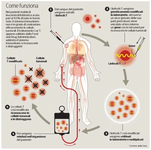 Il mondo del cancro è cambiato per sempre approvata la prima terapia genetica contro la leucemia ma il costo è altissimo