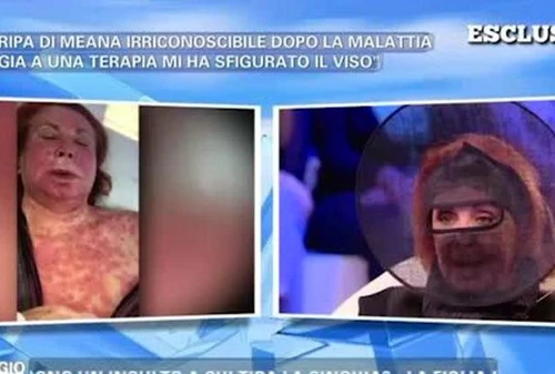 Marina Ripa di Meana irriconoscibile Sfigurata dalle terapie contro il cancro