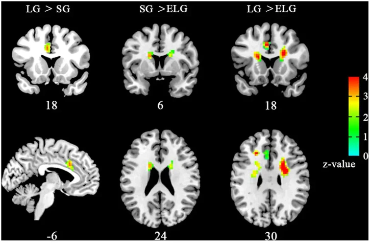 Alla ricerca dellamore ecco quali zone del cervello si illuminano quando si ama un partener un figlio o un animale