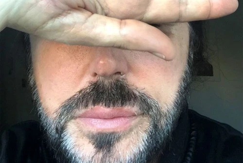 Scialpi insultato e sputato in faccia a Roma perché omossessuale