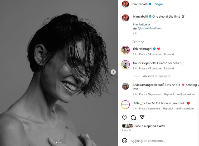 Bianca Balti si mostra nuda con la cicatrice e i capelli corti Oggi inizio la chemioterapia