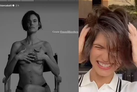 Bianca Balti si mostra nuda con la cicatrice e i capelli corti Oggi inizio la chemioterapia