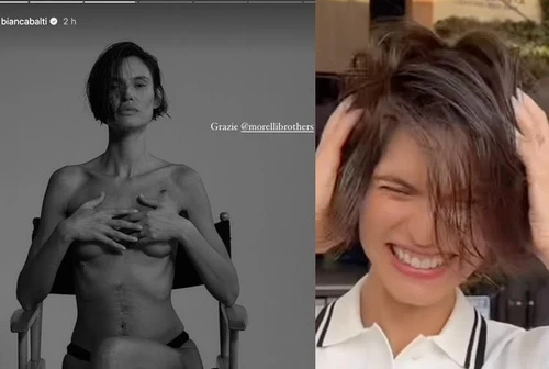 Bianca Balti si mostra nuda con la cicatrice e i capelli corti Oggi inizio la chemioterapia