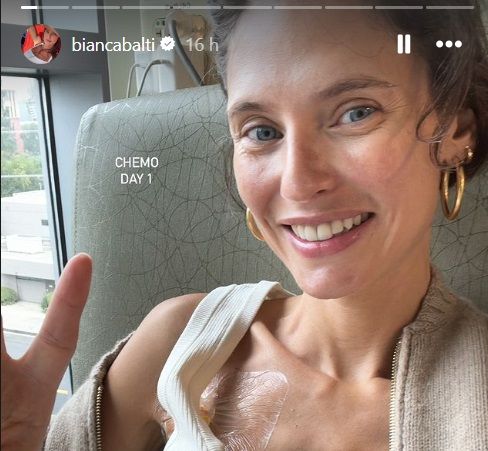 Bianca Balti ha iniziato la chemioterapia e si mostra come sempre sorridente e coraggiosa: il sostegno della figlia